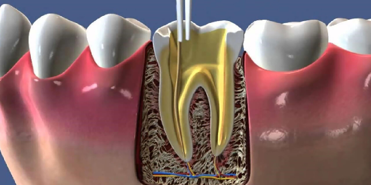 Erikli Derman Dental Diş Polikliniği